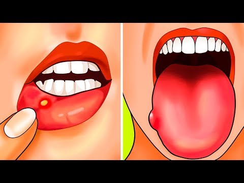 Видео о препарате Префолик (Prefolic) ампулы 50мг 3мл №6